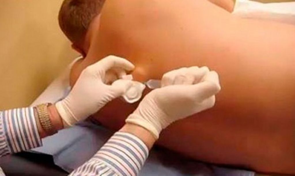 Treatment penis with antiseptic fight against