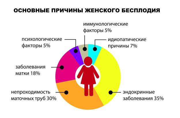 Виды бесплодия схема