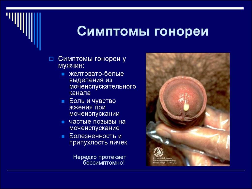 Ðð¾ð½ð¾ñðµñ ñ ð¼ñð¶ñð¸ð½. ð¡ð¸ð¼ð¿ñð¾ð¼ñ