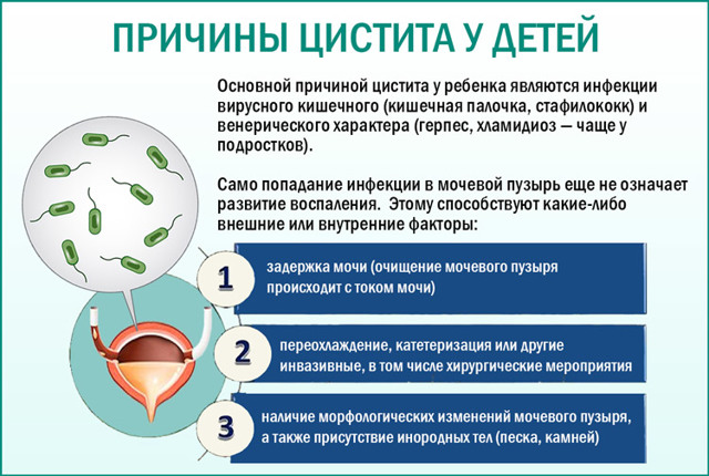 Примеси в моче у ребенка фото с пояснениями