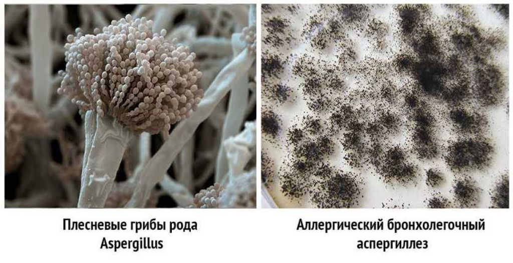 Патогенные грибы споры