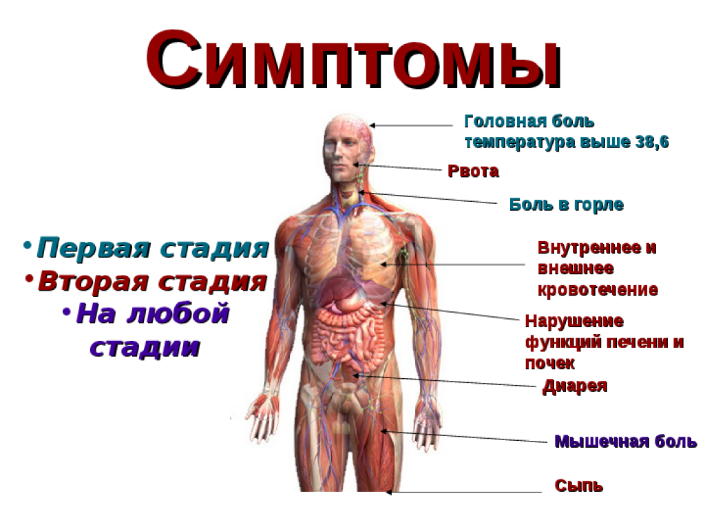 Симптомы лихорадки у человека
