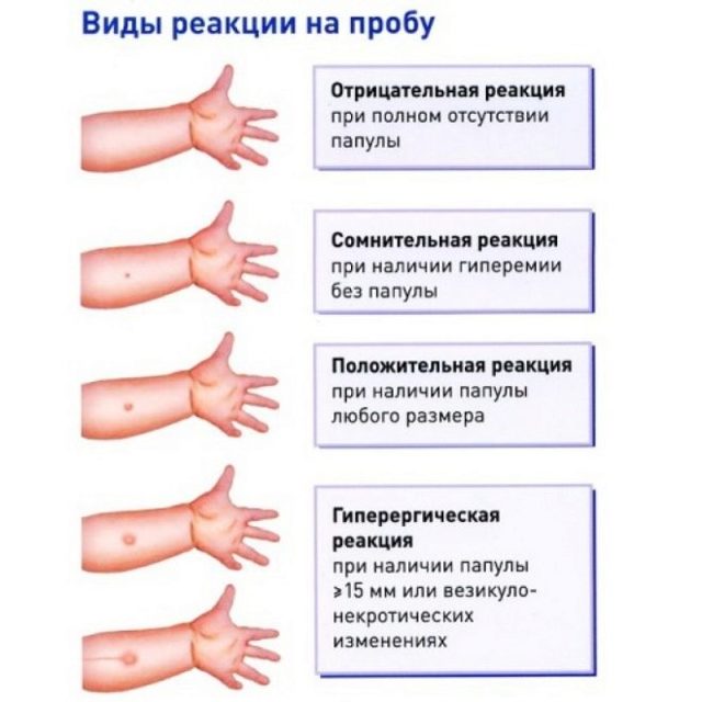 Фото диаскинтеста по дням