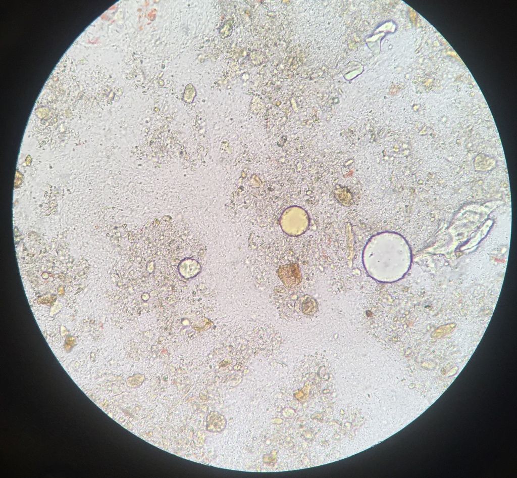 Растительная клетчатка в копрограмме. Микроскопия кала копрограмма. Микроскопия кала растительная клетчатка. Микроскопия кала переваримая клетчатка. Атлас копрограмма микроскопия.