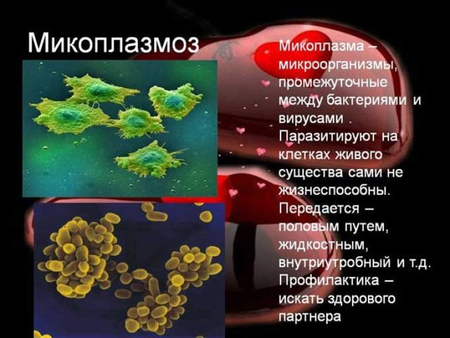 Уреаплазма парвум у женщин схема лечение форум