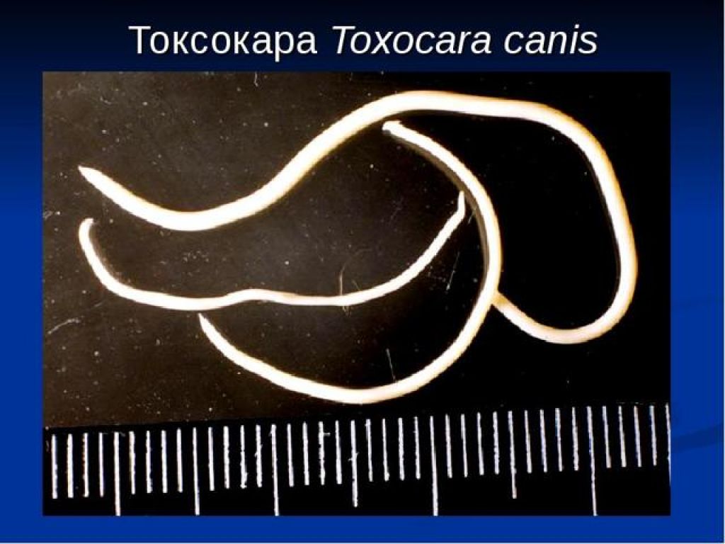 Токсокароз у детей фото