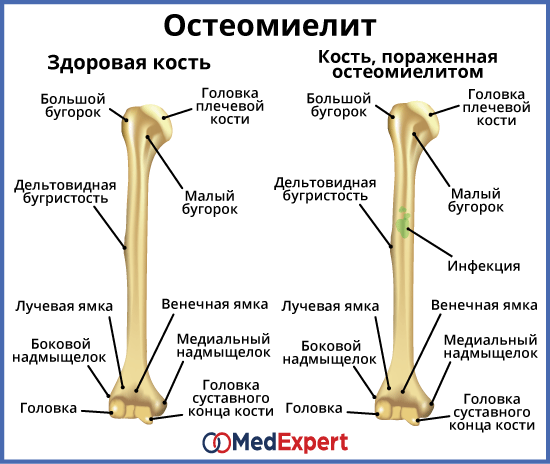 Надкостница челюсти фото