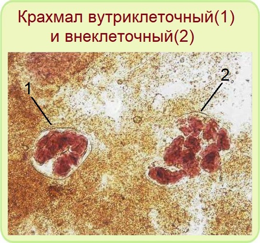 Прожилки крови в кале у взрослого фото