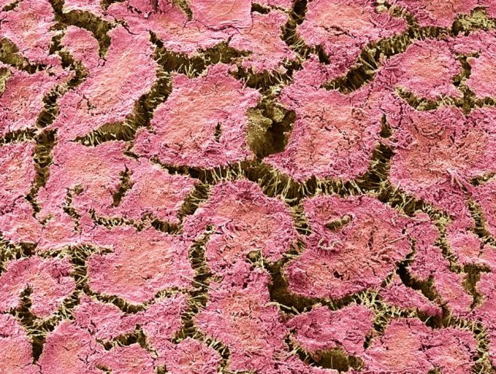 Налет на зубах под микроскопом фото для детей