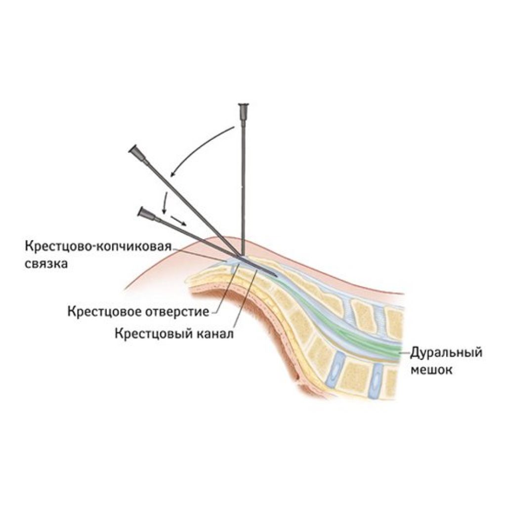 блокада по стиму фото 85