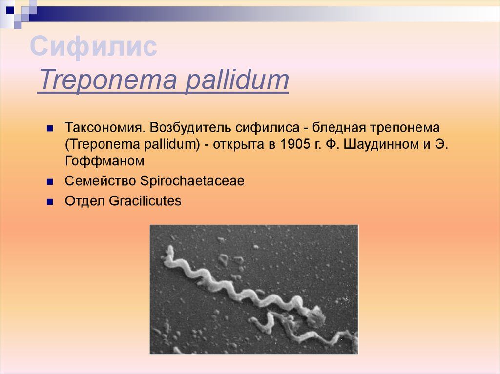 Бледная трепонема treponema pallidum. Спирилла бледная трепонема. Бледная трепонема таксономия. Спирохета возбудитель сифилиса.