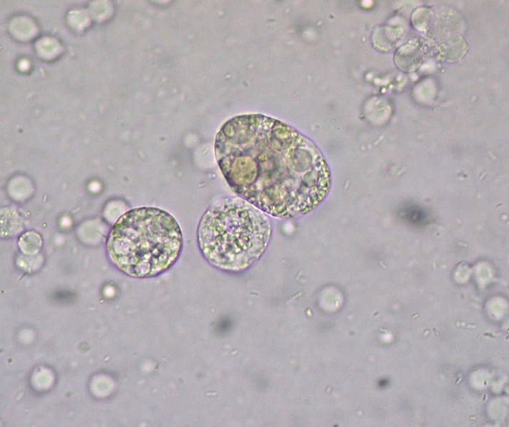 Лейкоциты в моче микроскопия