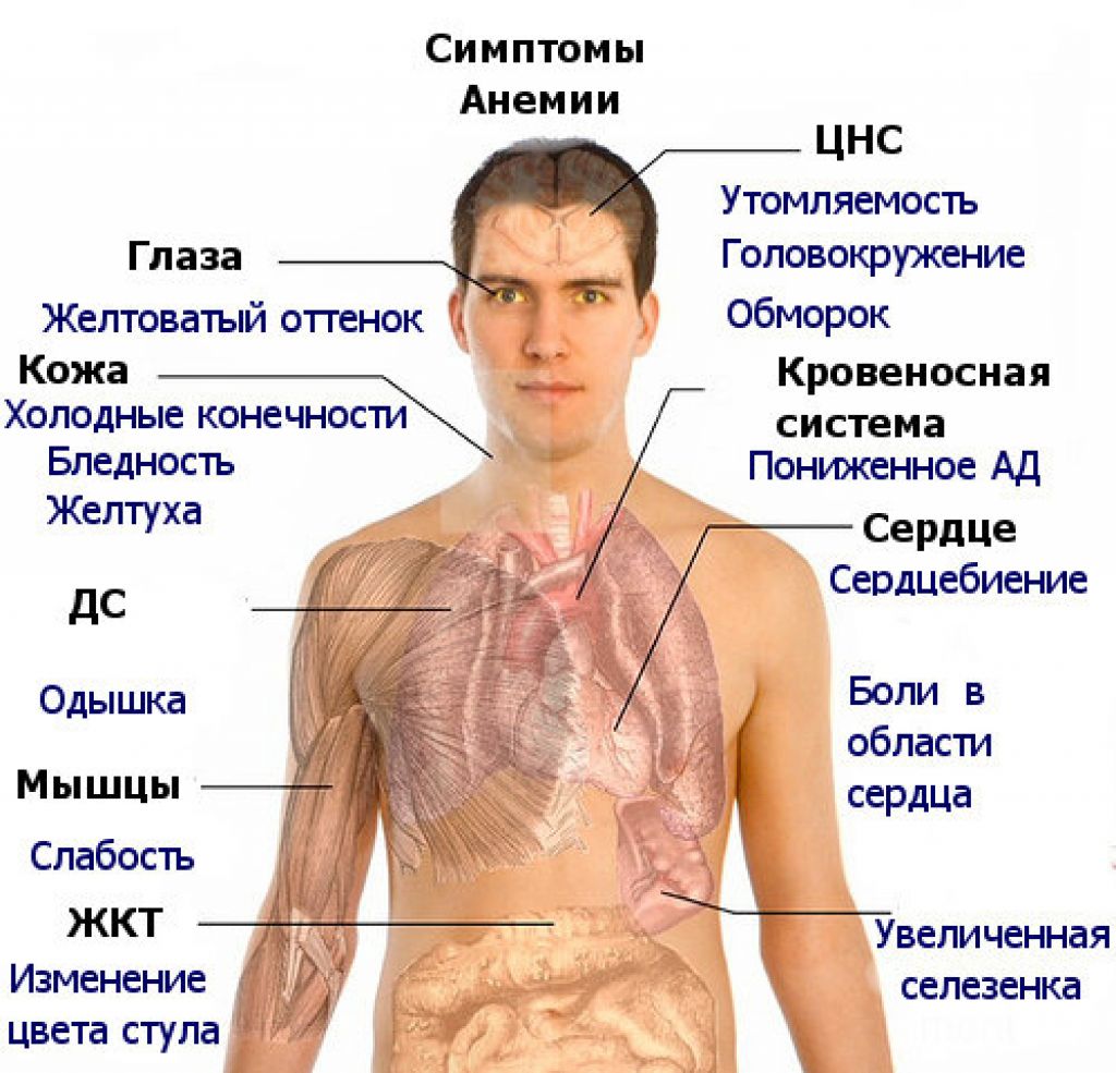 Назначения при анемии. Железодефицитная анемия симптомы. Железонедостаточная анемия симптомы. Симптомы железодеф анемии.