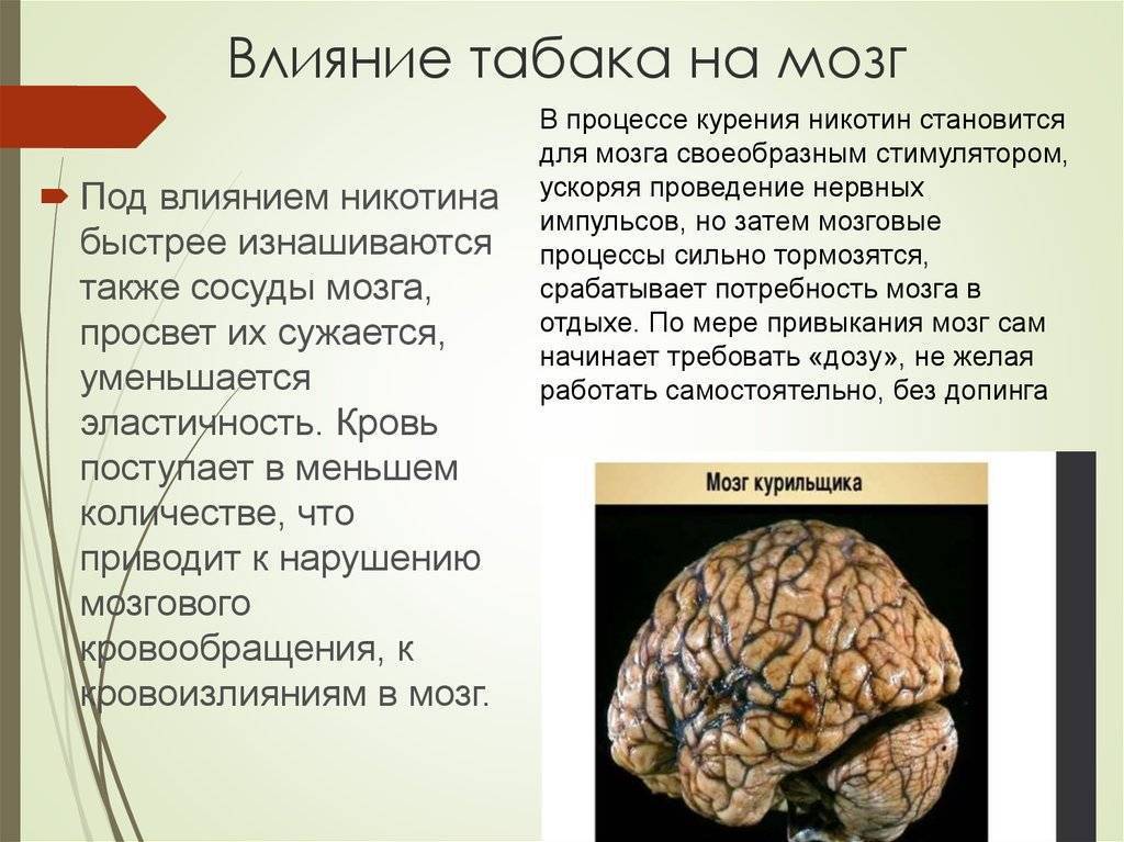 Дисциркуляторная сосудистая энцефалопатия ДЭП. Атеросклероз сосудов головного мозга. Церебральный атеросклероз. Диагностика и лечение - Медицинский центр Эхинацея