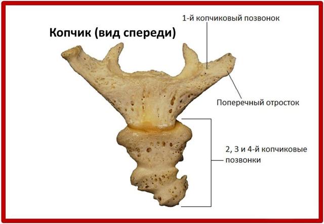 Пролежни на копчике фото