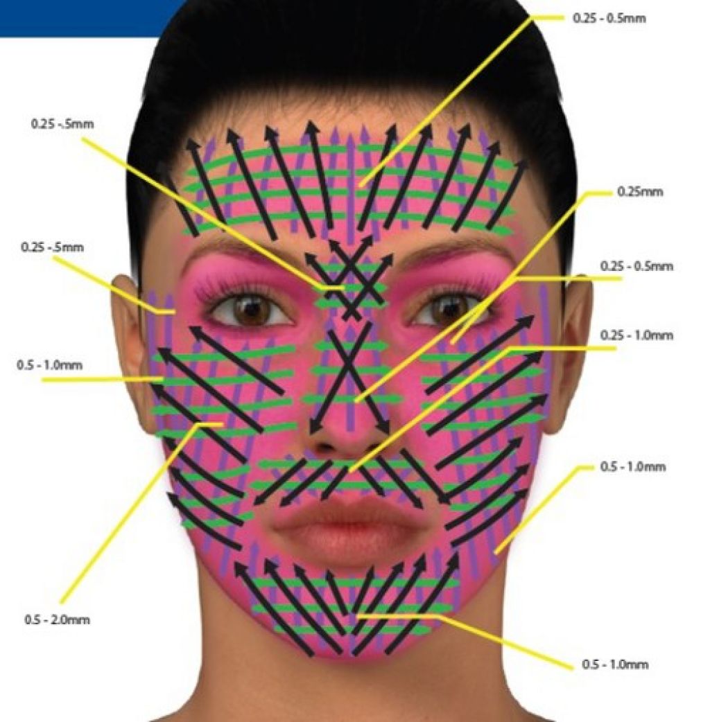 Схема массажа мезороллером на лице