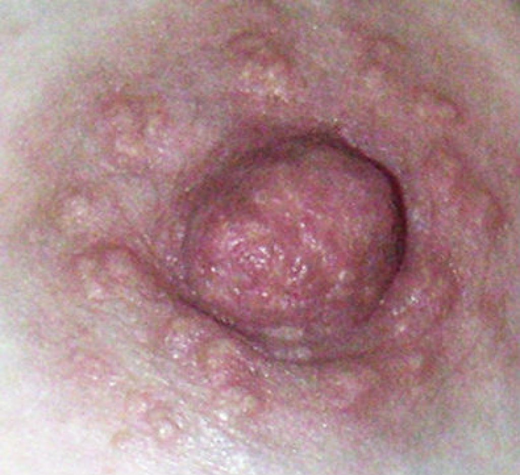 молозиво в груди у женщин фото 114