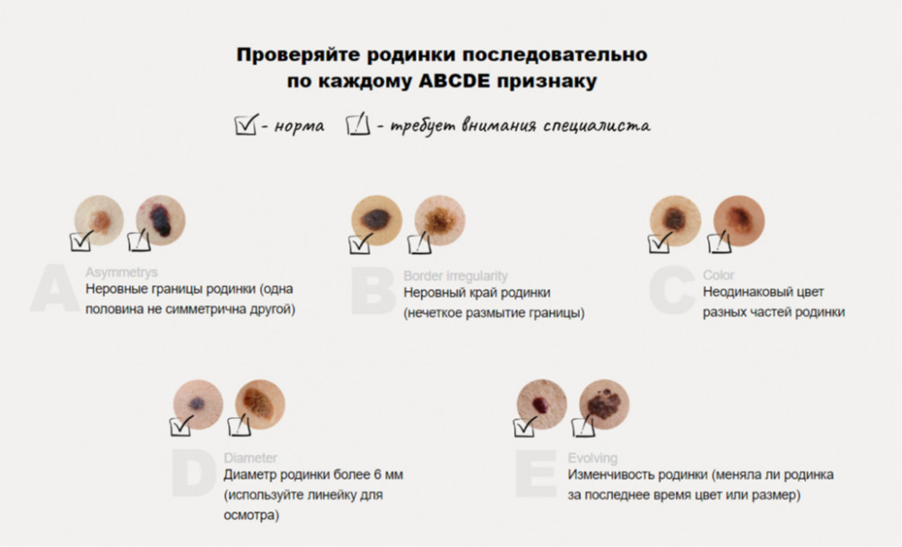 Красные родинки на теле причины появления у женщин фото