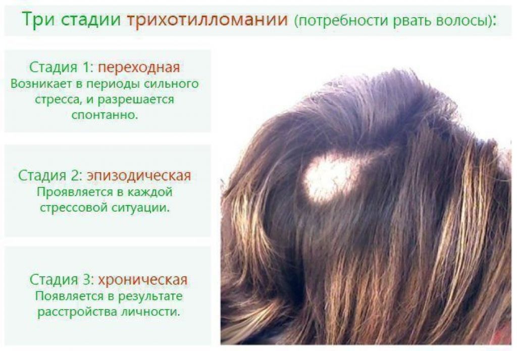 Признаки сильных волос. Вырывание волос на голове. Расстройство выдирание волос.
