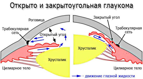 Глаукома: причины, симптомы, лечение и профилактика