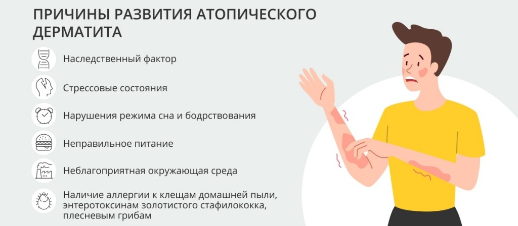 Атопический дерматит патогенез схема