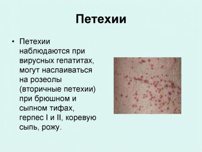 Петехиальная сыпь на коже - что это, причины
