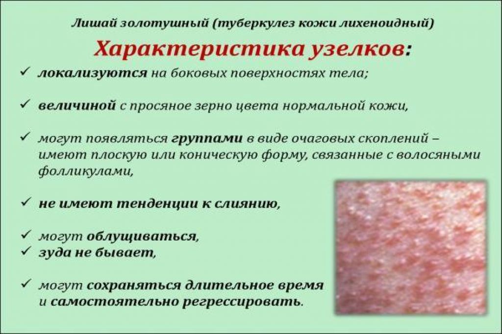 Виды проявления болезни. Туберкулезная волчанка сыпь. Кожные заболевания классификация. Заболевания кожи классификация.
