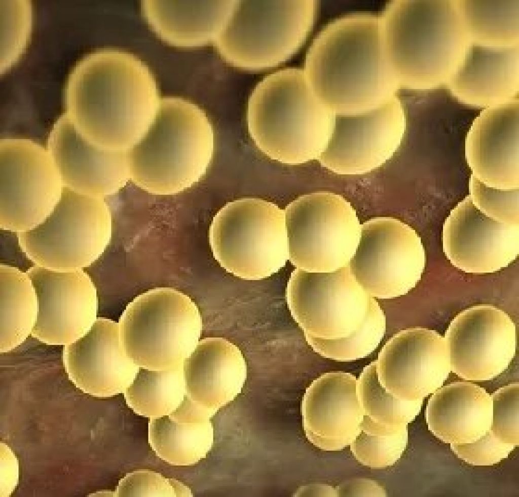 1 staphylococcus aureus. Стафилококкус ауреус. Стафилококки (s. aureus),. S. aureus золотистый стафилококк.