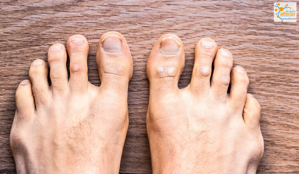 Борьба на пальцах ног