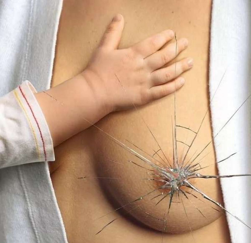 причины воспаления груди у женщин фото 110
