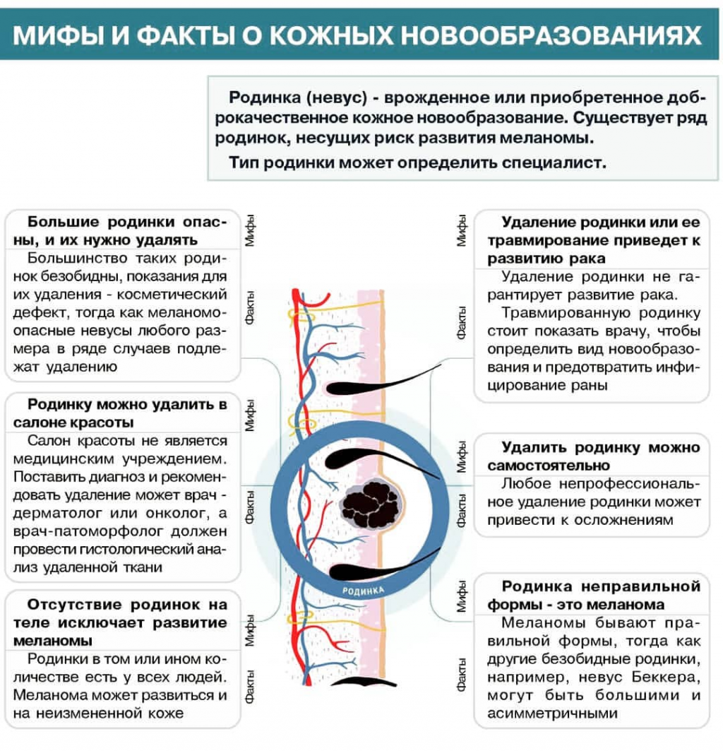 Родинки на теле и их значение у мужчин фото с названиями