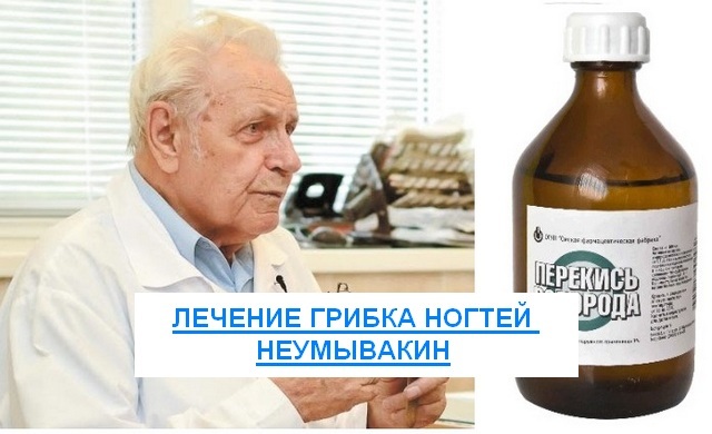 Перекись водорода от грибка ногтей: лечение, отзывы врачей
