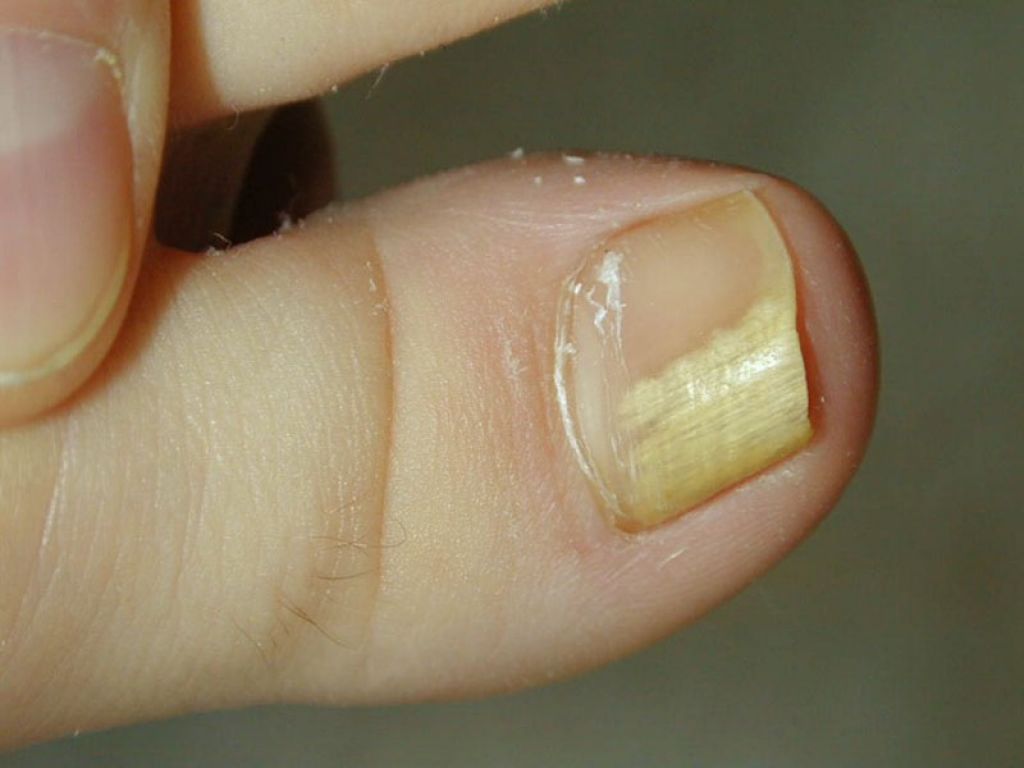 О каких заболеваниях говорят ногти на руках у женщины фото