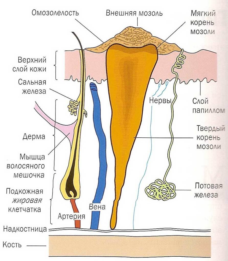 Сухая мозоль картинки