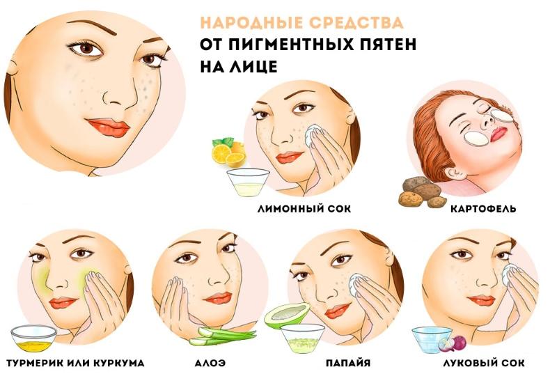 Советы косметолога. Как избавиться от пигментных пятен
