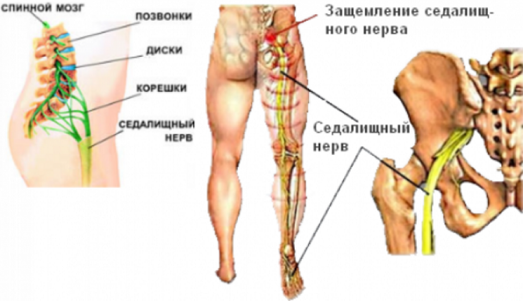 Симптомы боли седалищного нерва у мужчин. Анатомия седалищного нерва у человека. Седалищный нерв расположение анатомия. Седалищный нерв левая нога. Седалищный нерв в пояснице.