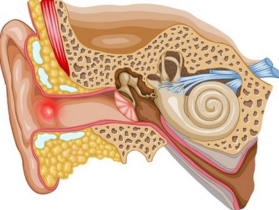 Фурункул внутри уха фото