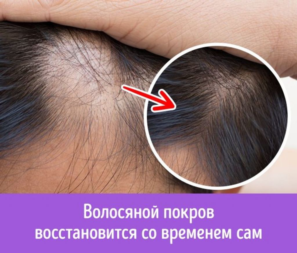 Избыток белка и выпадение волос