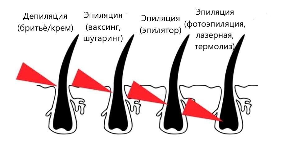 Картинки про депиляцию