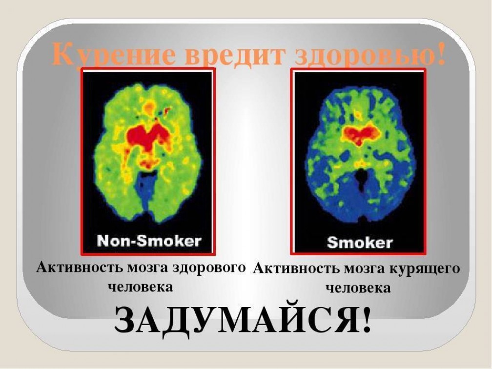 Мозг курильщика, влияние на него никотина и проблемы с мозгом при инсульте