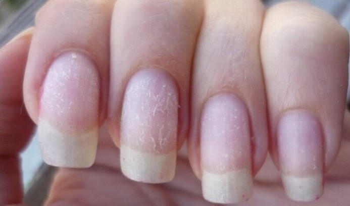 Почему ногти портятся от покрытия
