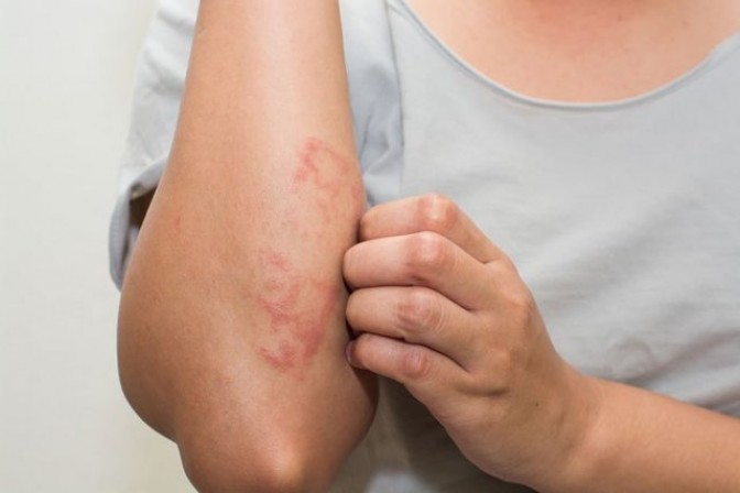 Водянистые пузырьки на коже — о каких заболеваниях говорят симптомы
