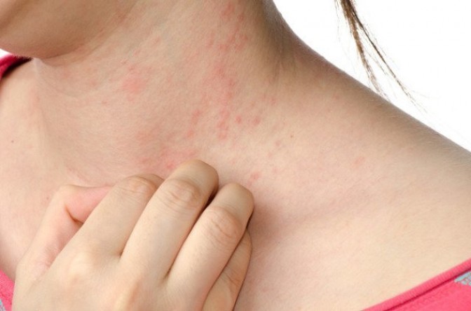 Водянистые пузырьки на коже — о каких заболеваниях говорят симптомы