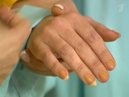 Как убрать желтизну от никотина с пальцев и ногтей? способов очистить кожу