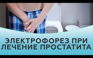 Применение свечей для лечения простатита и аденомы простаты