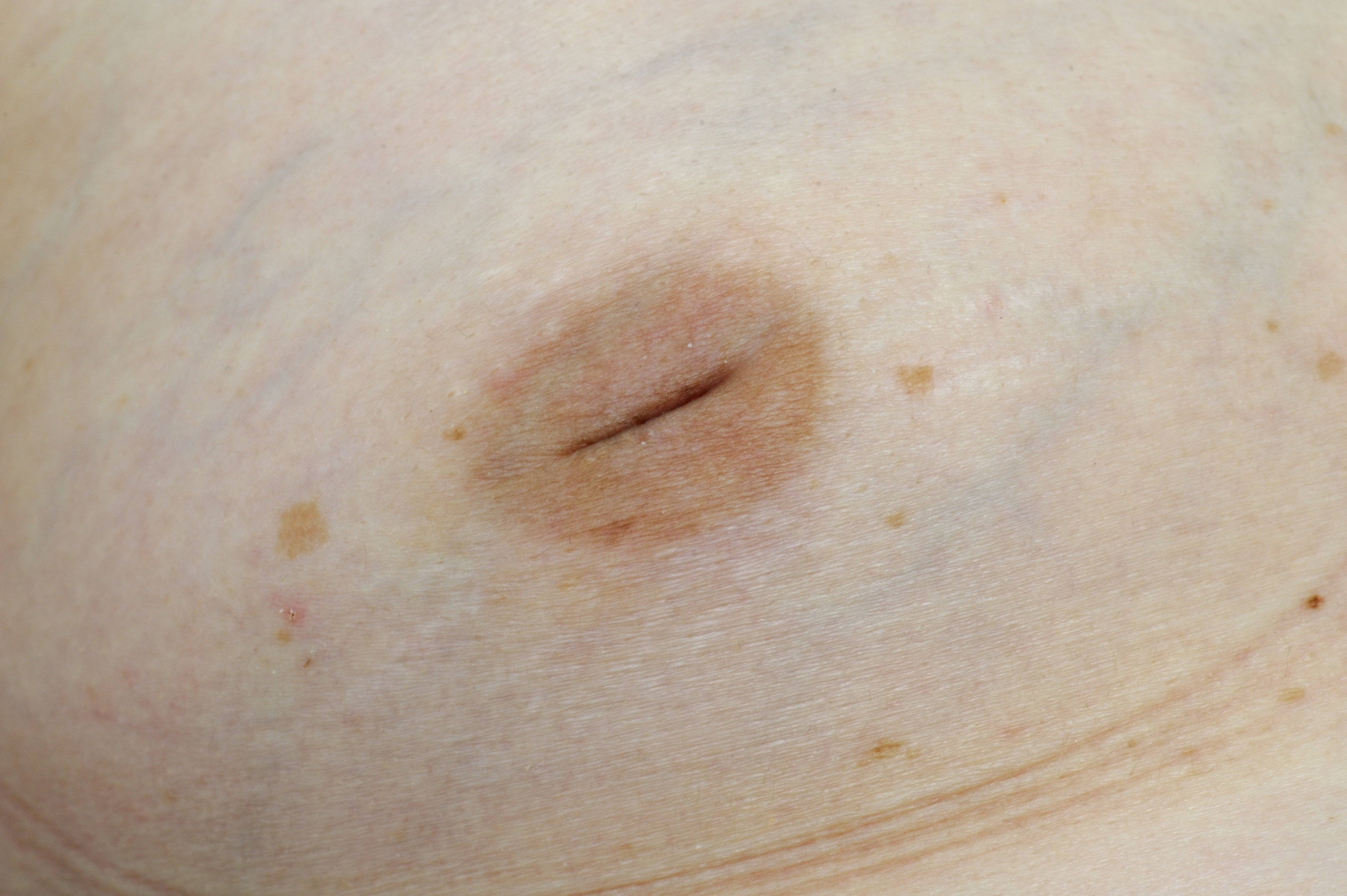 кожа на груди не упругая фото 112