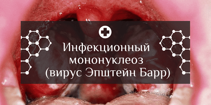 Как лечить вирус эпштейна-барр и что это такое?