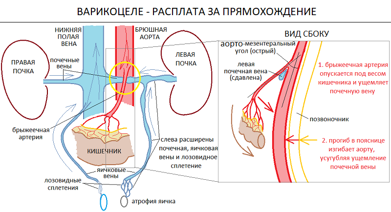 Варикоцеле почечная Вена. Аорто-мезентериальной компрессии левой почечной вены.. Артерии яичка