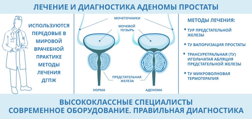 Какие антибиотики назначают при простатите и аденоме простаты?