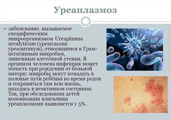 Ureaplasma parvum: характеристика, анализы, симптомы у женщин и мужчин, чем опасна, нужно ли лечить